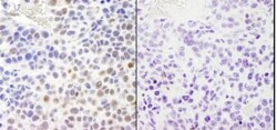 RPA2, p Ser4, p Ser8 Antibody, Novus Biologicals 0.1mL; Unlabeled:Antibodies,